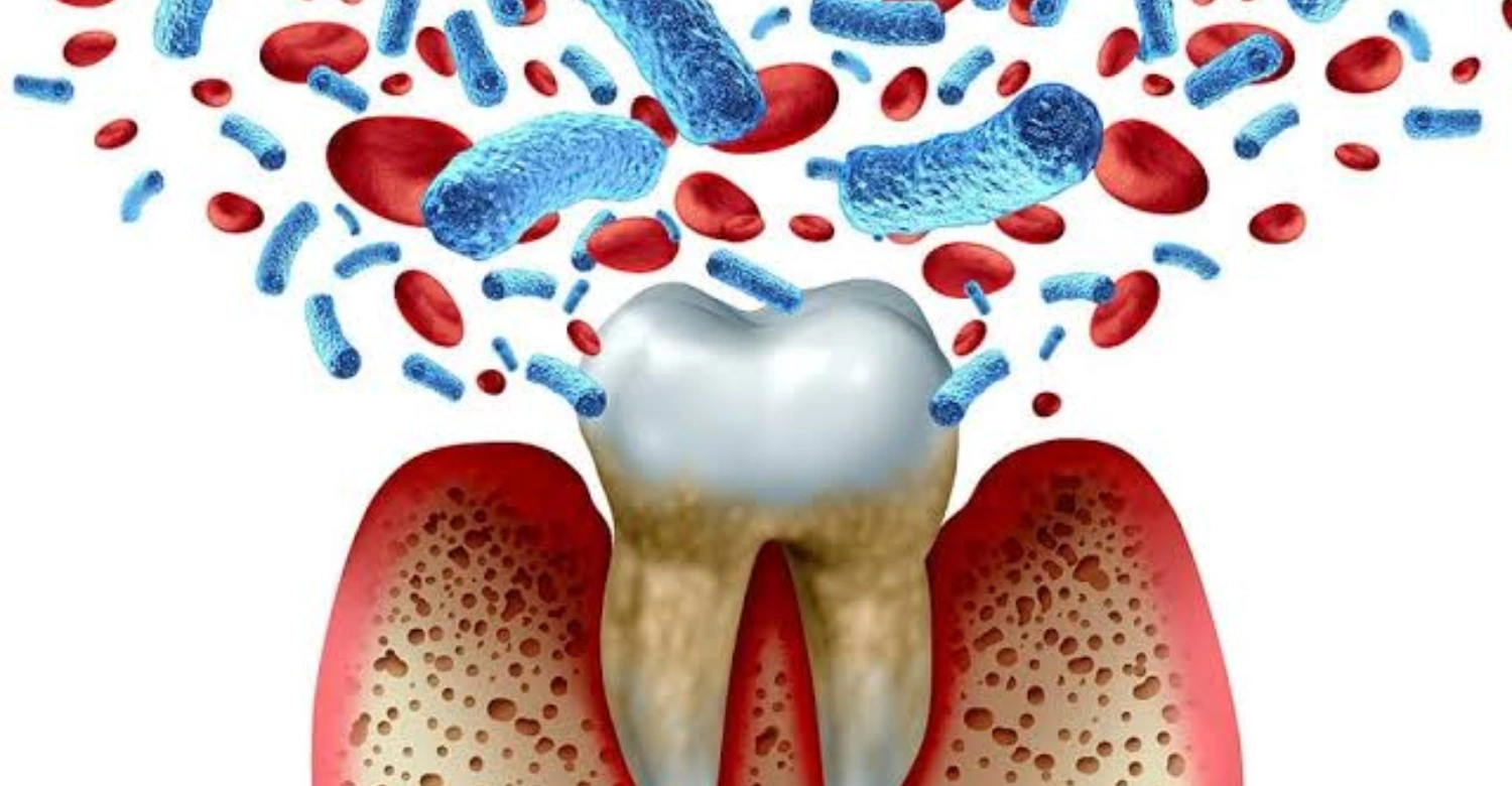 bacteria on teeth1